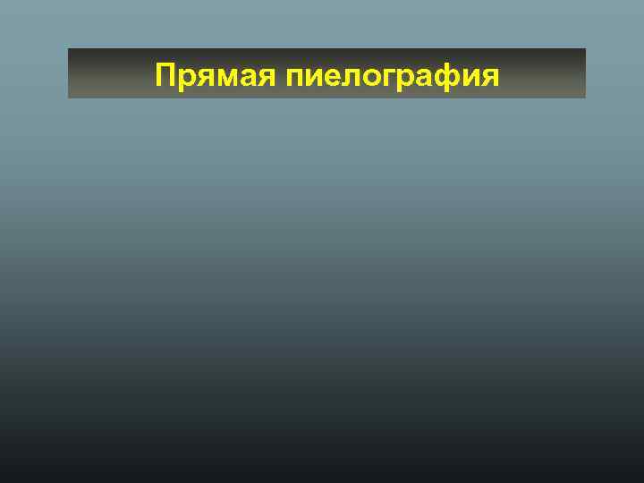 Прямая пиелография 