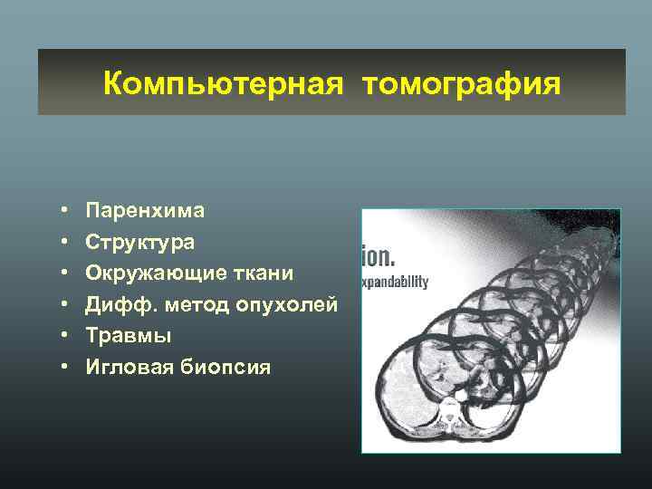 Компьютерная томография • • • Паренхима Структура Окружающие ткани Дифф. метод опухолей Травмы Игловая