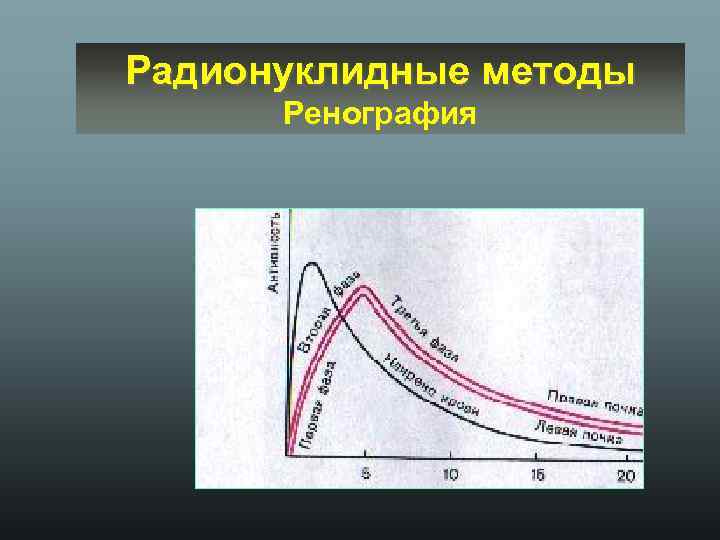 Радионуклидные методы Ренография 