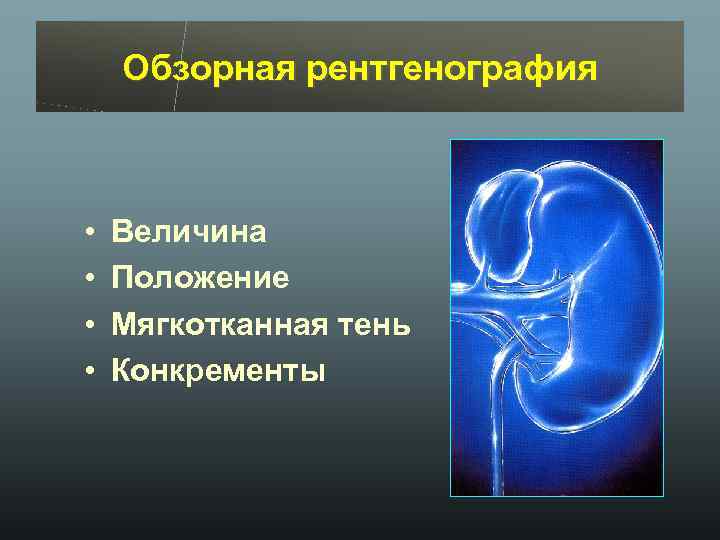 Обзорная рентгенография • • Величина Положение Мягкотканная тень Конкременты 