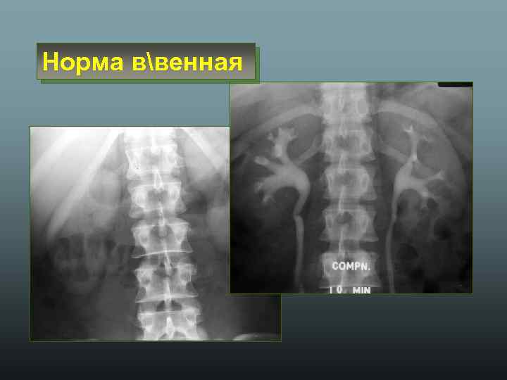 Норма ввенная 