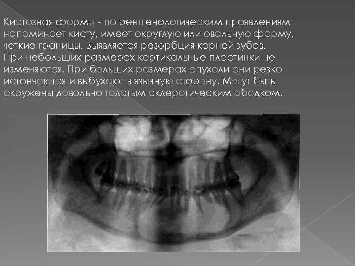 Диагностика новообразований челюстно лицевой области презентация