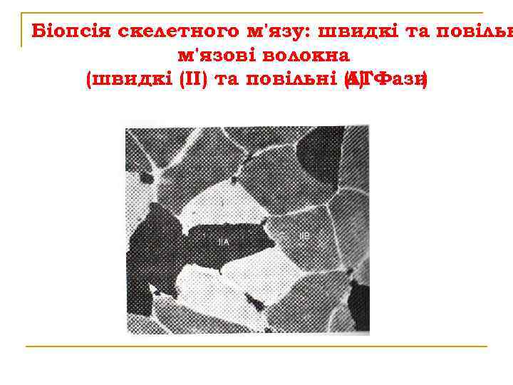 Біопсія скелетного м'язу: швидкі та повільн м'язові волокна (швидкі (ІІ) та повільні (І) АТФази