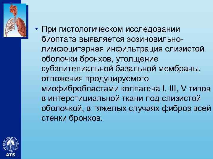  • При гистологическом исследовании биоптата выявляется эозиновильнолимфоцитарная инфильтрация слизистой оболочки бронхов, утолщение субэпителиальной