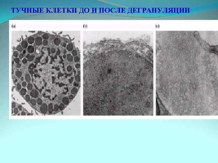 ТУЧНЫЕ КЛЕТКИ ДО И ПОСЛЕ ДЕГРАНУЛЯЦИИ 