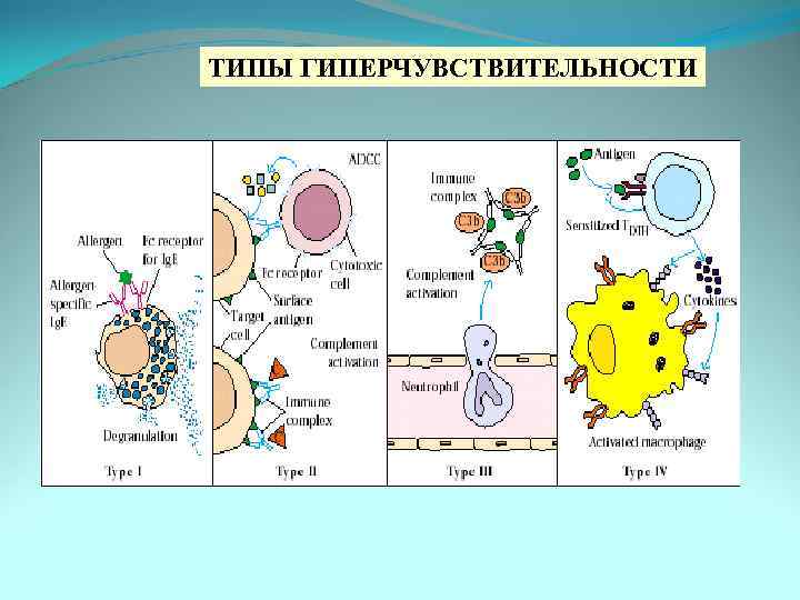 ТИПЫ ГИПЕРЧУВСТВИТЕЛЬНОСТИ 