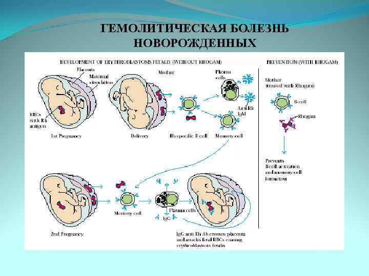 ГЕМОЛИТИЧЕСКАЯ БОЛЕЗНЬ НОВОРОЖДЕННЫХ 