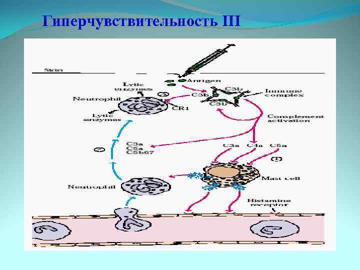 Гиперчувствительность III 