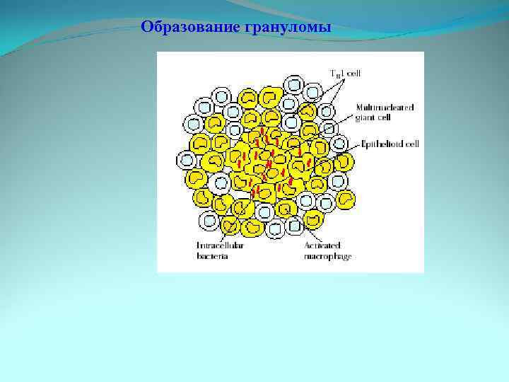 Образование грануломы 