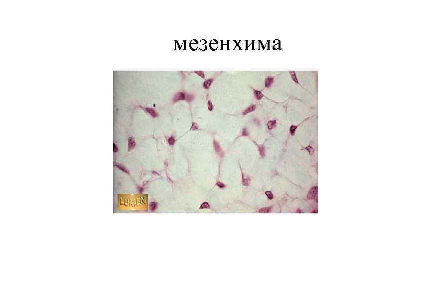 Мезенхима. Мезенхима зародыша гистология. Соединительная ткань мезенхима. Мезенхима зародыша цыпленка препарат.