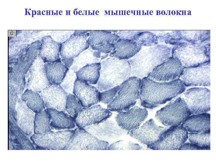 Красные и белые мышечные волокна 