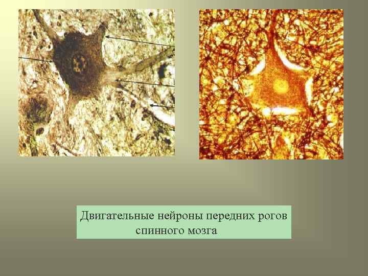 Двигательные нейроны передних рогов спинного мозга 