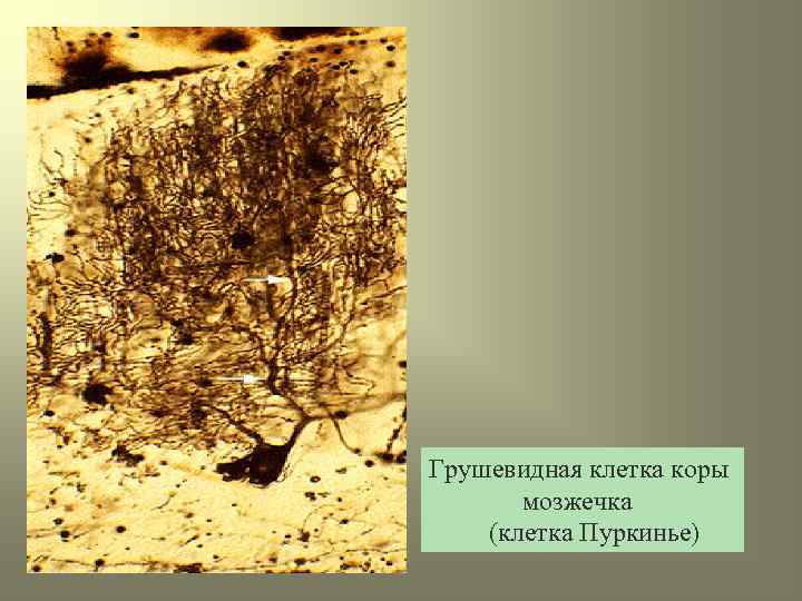 Грушевидная клетка коры мозжечка (клетка Пуркинье) 