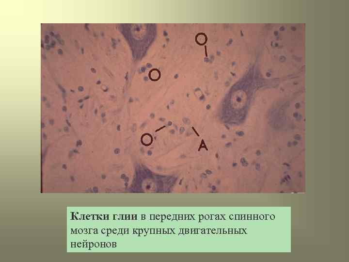 Клетки глии в передних рогах спинного мозга среди крупных двигательных нейронов 