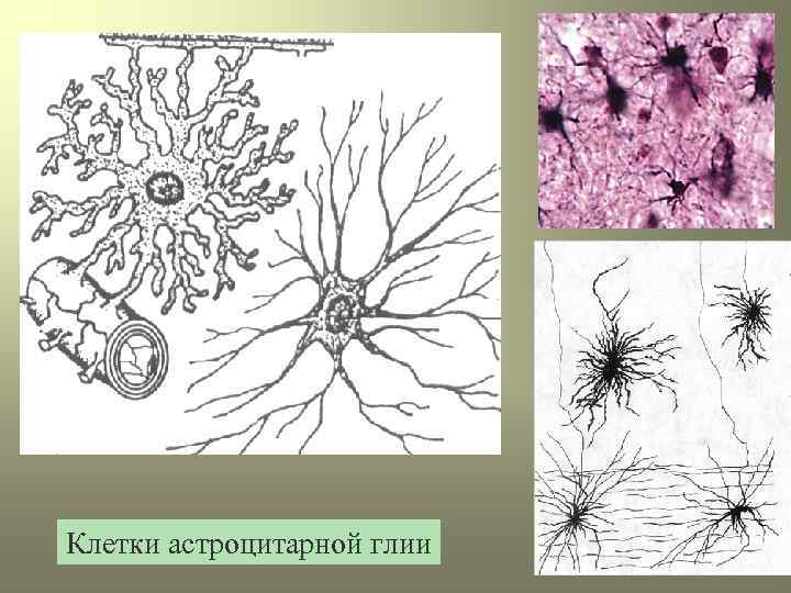 Клетки астроцитарной глии 