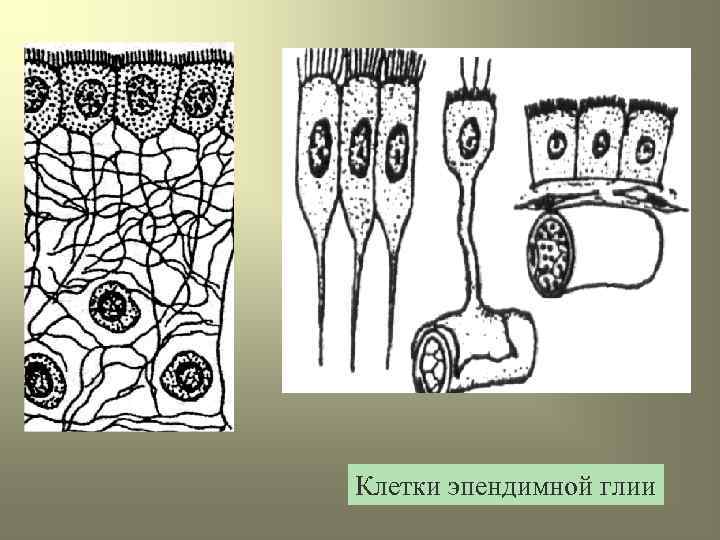 Клетки эпендимной глии 