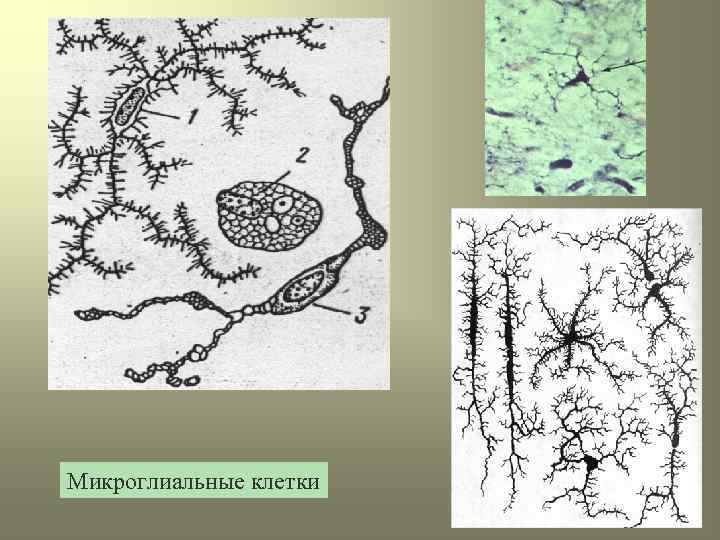 Микроглиальные клетки 