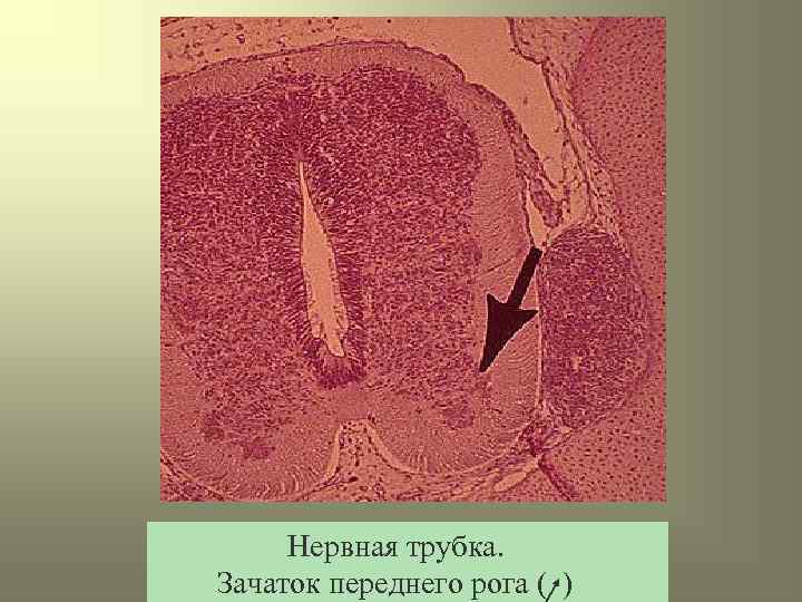 Нервная трубка. Нервная трубка гистология. Строение нервной трубки гистология. Образование нервной трубки гистология. Строение нервной трубки.