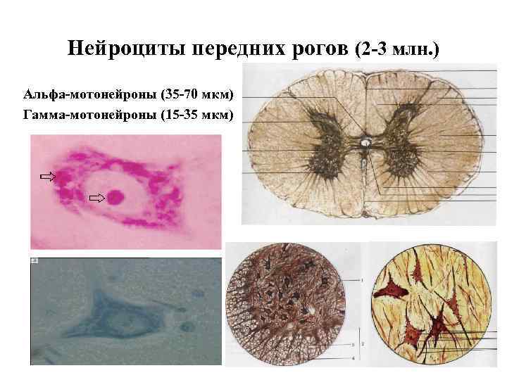 Нейроциты передних рогов (2 -3 млн. ) Альфа-мотонейроны (35 -70 мкм) Гамма-мотонейроны (15 -35