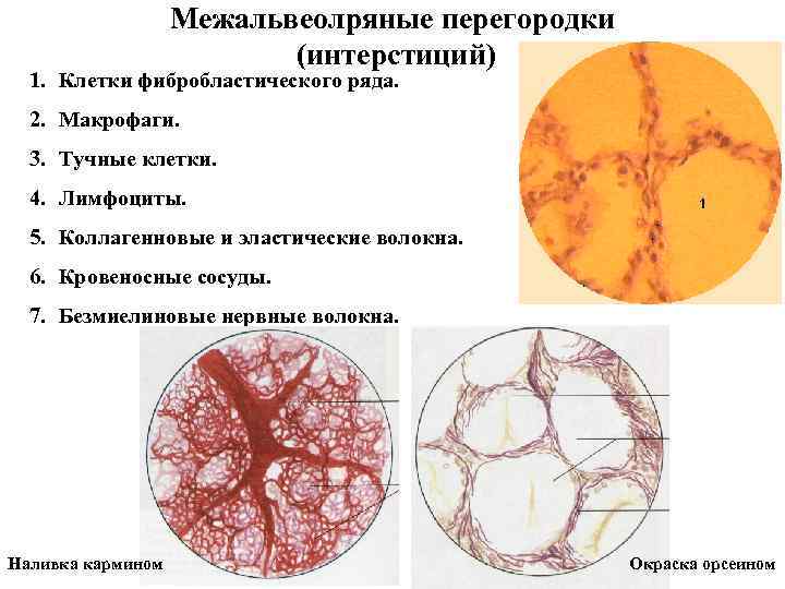 Межальвеолряные перегородки (интерстиций) 1. Клетки фибробластического ряда. 2. Макрофаги. 3. Тучные клетки. 4. Лимфоциты.