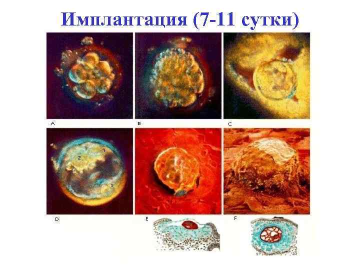 Имплантация (7 -11 сутки) 