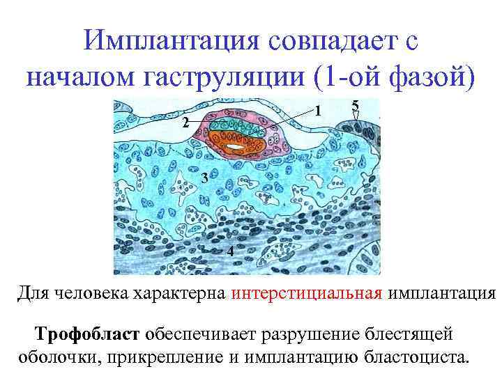 Имплантация совпадает с началом гаструляции (1 -ой фазой) Для человека характерна интерстициальная имплантация Трофобласт