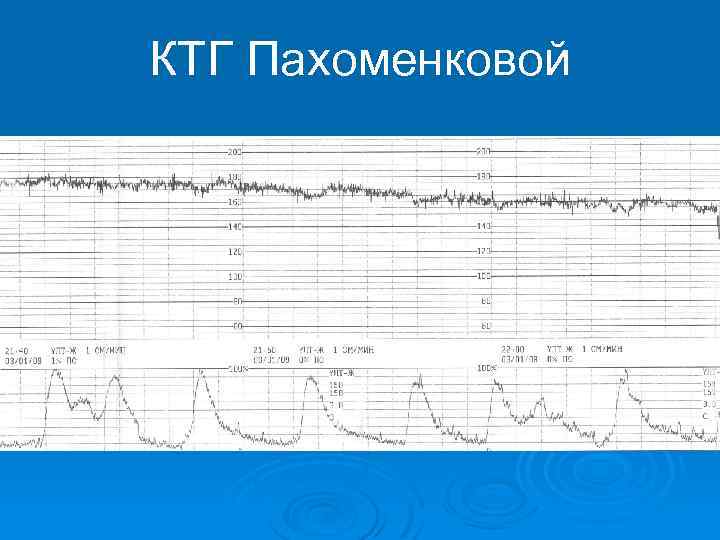 КТГ Пахоменковой 