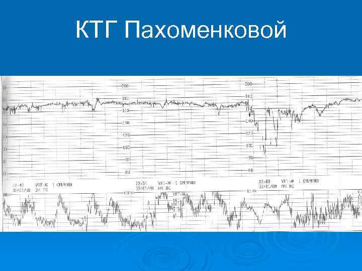 КТГ Пахоменковой 