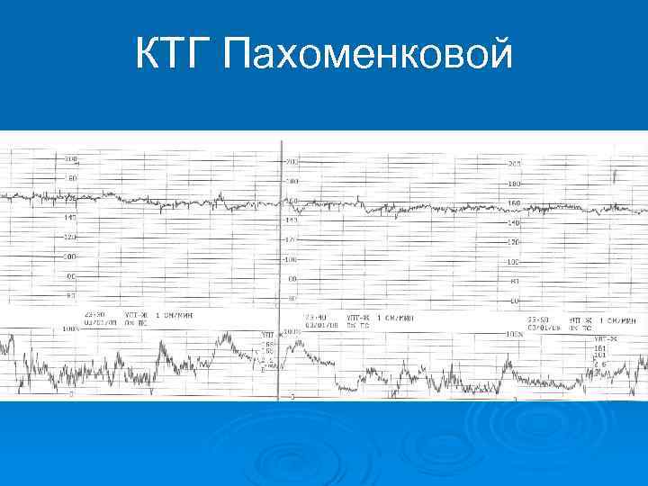 КТГ Пахоменковой 