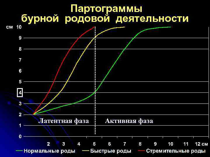 Партограммы бурной родовой деятельности Латентная фаза Активная фаза 