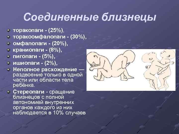 Соединенные близнецы торакопаги - (25%), торакоомфалопаги - (30%), омфалопаги - (20%), краниопаги - (8%),