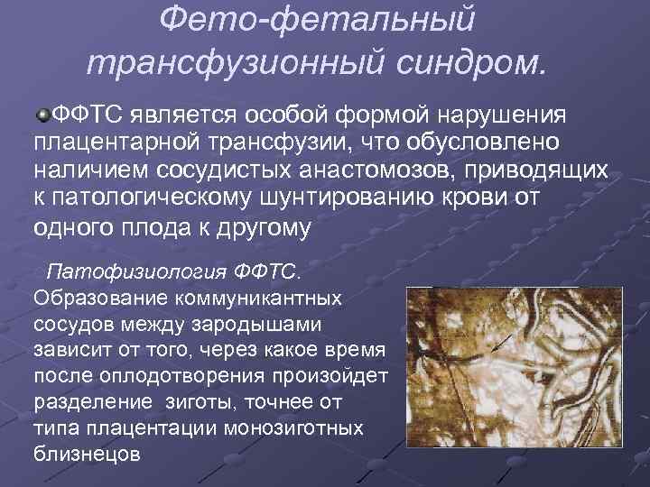 Фето-фетальный трансфузионный синдром. ФФТС является особой формой нарушения плацентарной трансфузии, что обусловлено наличием сосудистых