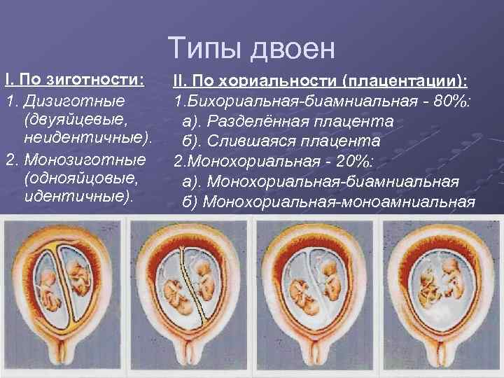 Диамниотическая двойня. Монохориальная хориальность. Монохориальная диамниотическая Близнецы. Монохориальная плацентация. Монохориальная моноамниотическая беременность.