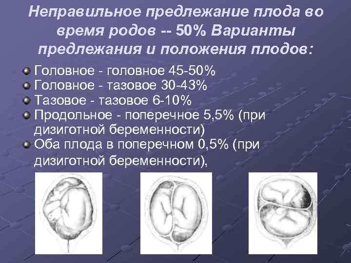 Предлежание плода при беременности