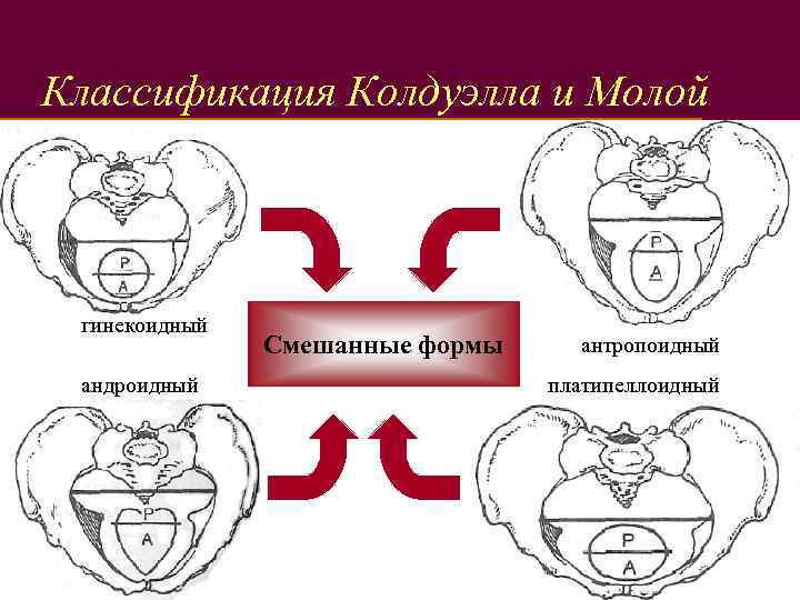 Классификация Колдуэлла и Молой гинекоидный андроидный Смешанные формы антропоидный платипеллоидный 