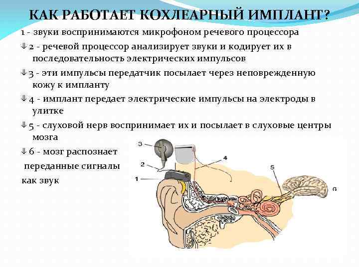 Работа с кохлеарной имплантацией