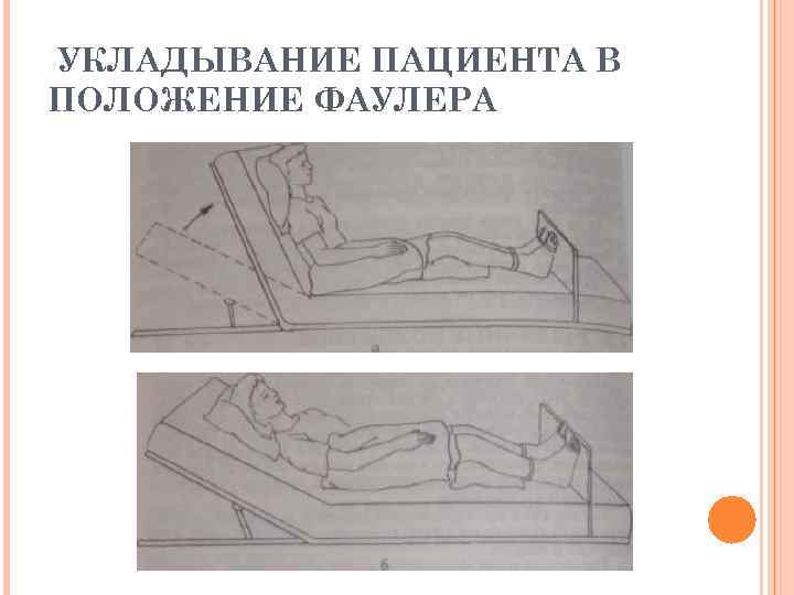 УКЛАДЫВАНИЕ ПАЦИЕНТА В ПОЛОЖЕНИЕ ФАУЛЕРА 
