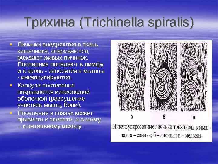 Инкапсулированные личинки трихинеллы в мышцах рисунок с обозначениями