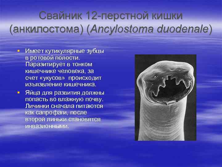 Свайник 12 -перстной кишки (анкилостома) (Ancylostoma duodenale) § Имеет кутикулярные зубцы в ротовой полости.