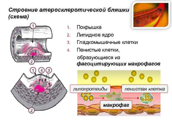 Схема строения пейеровой бляшки