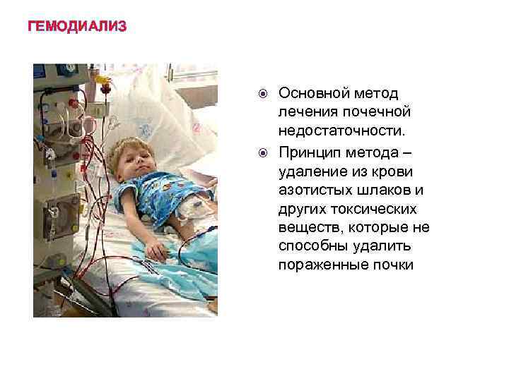 ГЕМОДИАЛИЗ Основной метод лечения почечной недостаточности. Принцип метода – удаление из крови азотистых шлаков