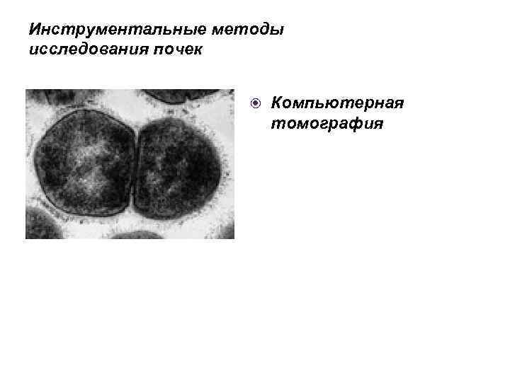 Инструментальные методы исследования почек Компьютерная томография 