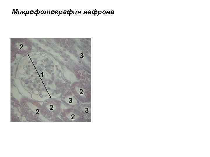 Микрофотография нефрона 