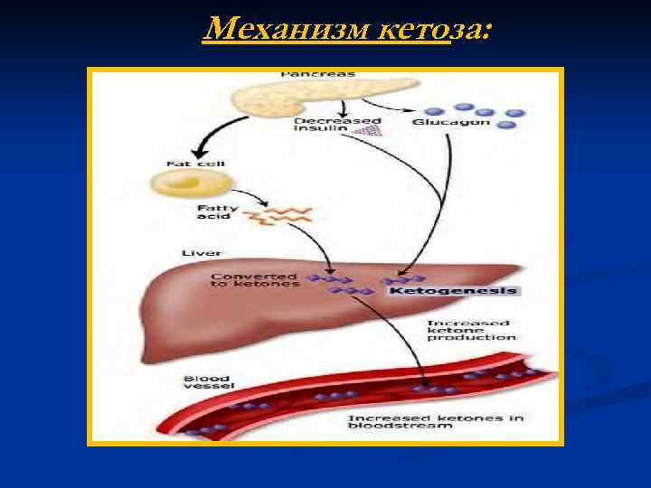 Механизм кетоза: 