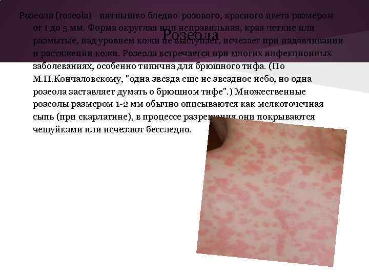 Розеола (roseola) - пятнышко бледно-розового, красного цвета размером от 1 до 5 мм. Форма