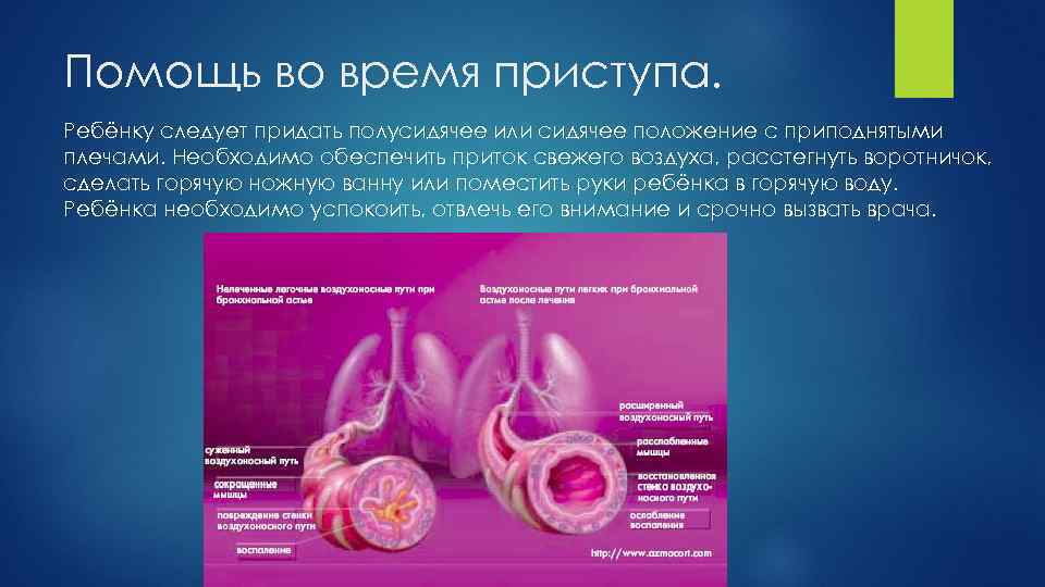 Помощь во время приступа. Ребёнку следует придать полусидячее или сидячее положение с приподнятыми плечами.