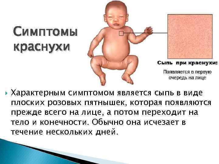 Cимптомы краснухи Характерным симптомом является сыпь в виде плоских розовых пятнышек, которая появляются прежде