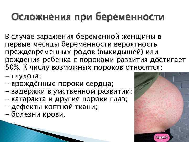 Осложнения при беременности В случае заражения беременной женщины в первые месяцы беременности вероятность преждевременных