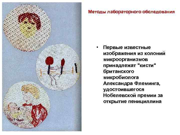 Методы лабораторного обследования • Первые известные изображения из колоний микроорганизмов принадлежат "кисти" британского микробиолога