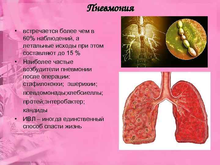 Пневмония • встречается более чем в 60% наблюдений, а летальные исходы при этом составляют